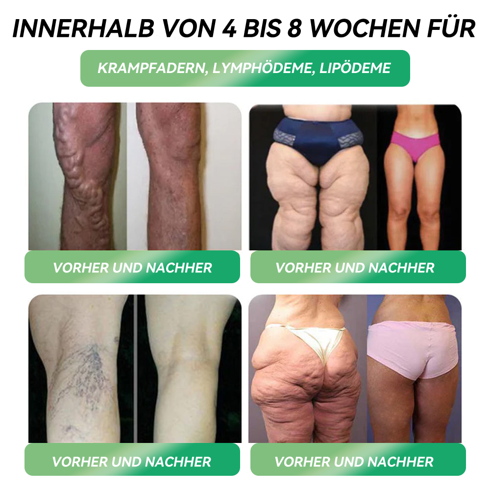 𝐇𝗛𝑉𝖡® 🇩🇪𝐆𝗟𝑷-1 𝐒𝐄𝐂𝐇𝐒 𝐈𝐍 𝐄𝐈𝐍𝐄𝐌 𝐆𝐞𝐬𝐮𝐧𝐝𝐡𝐞𝐢𝐭𝐬𝐥ö𝐬𝐮𝐧𝐠🍀🍀, 𝐟𝐥ü𝐬𝐬𝐢𝐠 𝐳𝐮𝐦 𝐄𝐢𝐧𝐧𝐞𝐡𝐦𝐞𝐧 (Nur eine Dosis pro Tag, sichtbare Veränderungen in 7 Tagen) ✅ Für Fettleibigkeit, kardiovaskuläre Gesundheit, Diabetes, Schlafapnoe, Gelenkprobleme und mehr.